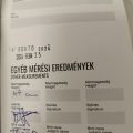 Mérési eredmény